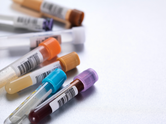 Lo screening salva vite e fa risparmiare